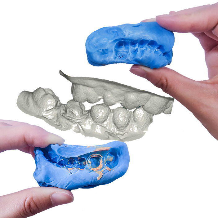 Dental 3D Scanner